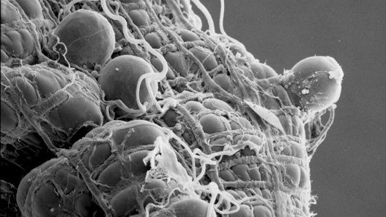 Parasites - New Hygiene Spray Fights Eyelid Parasites